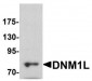 DNM1L / DRP1 Antibody (Internal)
